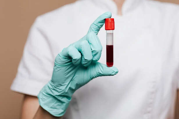 The Power of Early Detection