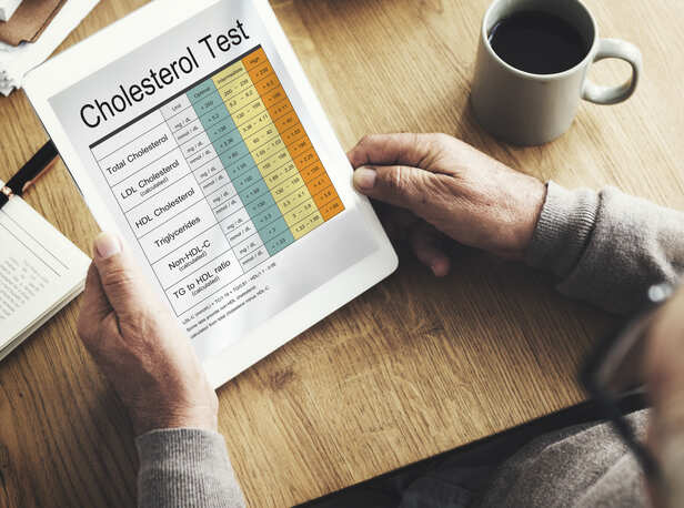 cholestrol test