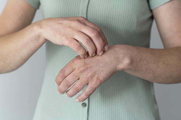 itchiness in hand