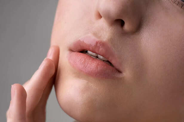 Lip Care Tips