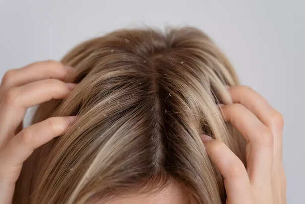 Scalp