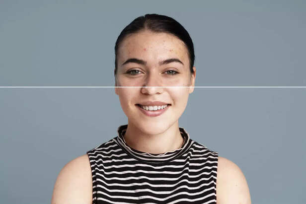 Are Whitening Claims Back