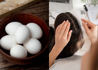 Say Goodbye to Dandruff F