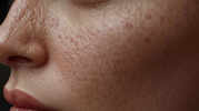 Natural Face Masks to Minimize Open Pores and Enhance Glow